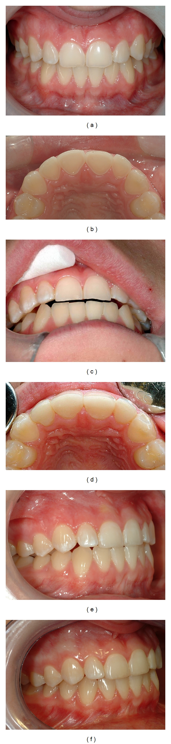 Figure 11