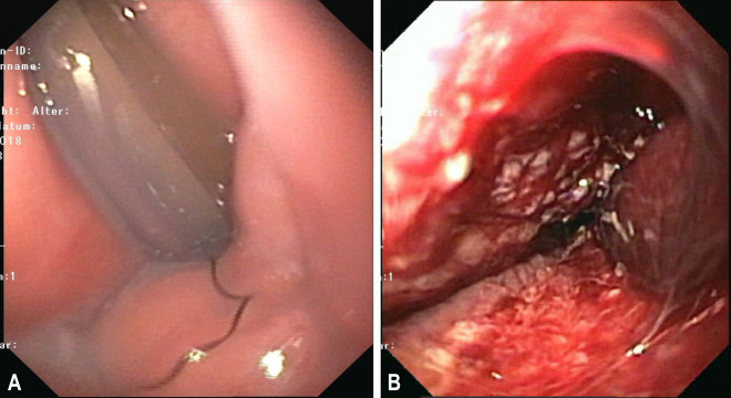 Figure 6: