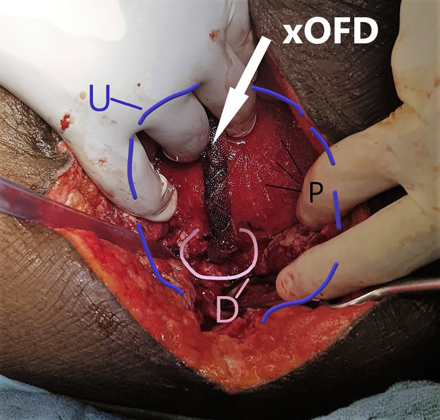 Figure 4: