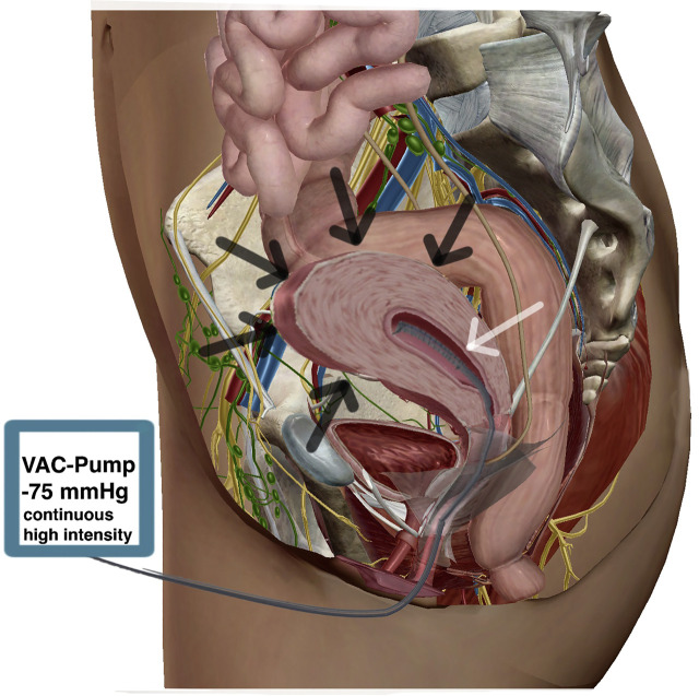 Figure 5: