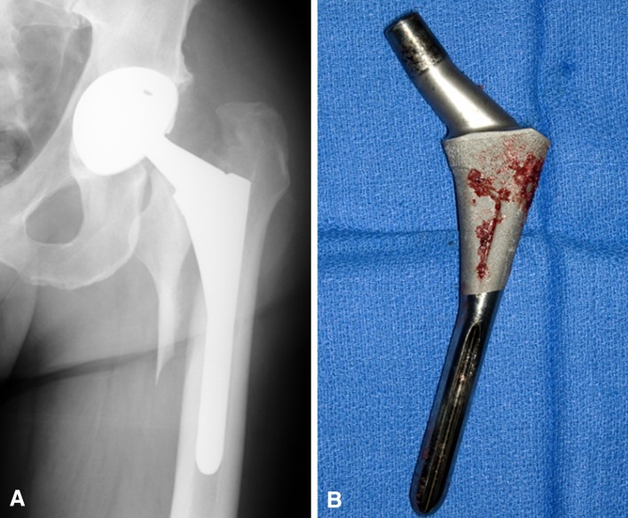 Fig. 2A–B