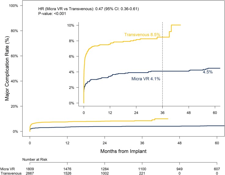 Leadless pacemakers at 5-year follow-up: the Micra transcatheter pacing ...