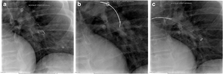 Fig. 5