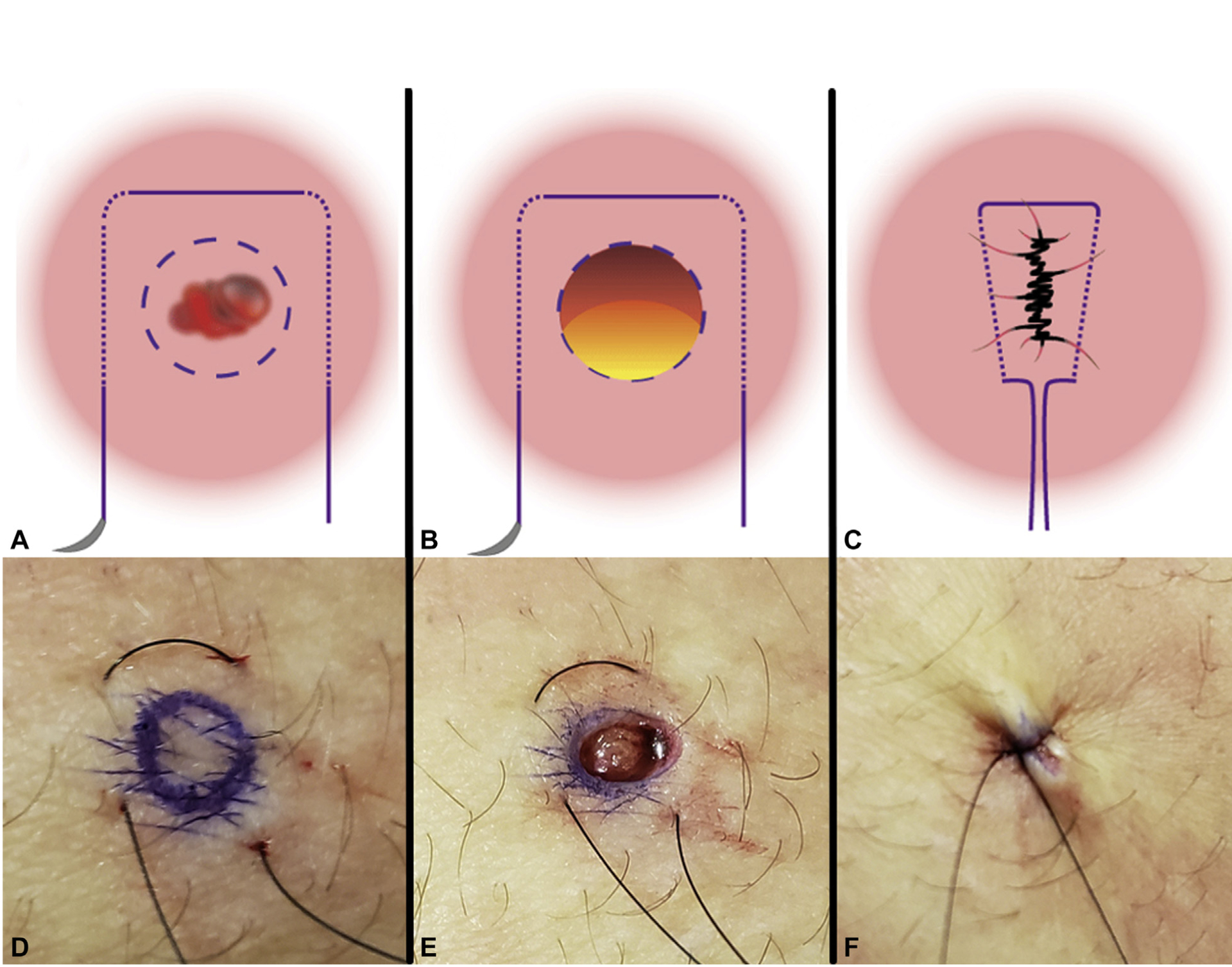 Fig 1.