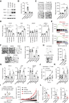Figure 5. Tumor inflammation-elicited PIM2 expression displays an oncogenic function in hepatoma. A–D, Huh7 cells were incubated with T cell-CM, TAM-CM, or Co-CM for 24 hours. The proteins of survival-related genes (A) and apoptosis (B) in serum-starved tumor cells (n = 7), the migration of cells (C, n = 7), and the expression of EMT markers in cells (D, n = 4) were determined. Scale bar, 100 μm. E, GSEA of the metastasis and EMT-like signatures in PIM2high HCC samples versus PIM2low counterparts from the TCGA dataset. (F and G) Huh7 cells were pretreated with Co-CM for 12 hours, and then the effects of PIM2 inhibitor or knockdown of PIM2 expression with psi-LVRU6GP retroviral vector (shPIM2) on tumor cell migration (F, n = 6) and EMT marker expression (G, n = 4) were determined. Scale bar, 100 μm. H, Huh7 cells were left untreated or treated with a cocktail of cytokines, and the migration of cells was determined (n = 6). Scale bar, 100 μm. I, shNC and shPIM2 Huh7 cells were pretreated with or without Co-CM for 12 hours and then inoculated into dorsal tissues of NOD/SCID mice. Tumor sizes over the indicated time were analyzed (n = 7). (J and K) PIM2+ Huh7 cells were generated by incubating with Co-CM for 12 hours. Apoptosis of cells after exposure to activated T cells was determined at the indicated times (n = 4), and the effect of PIM2 inhibitor or knockdown of PIM2 expression with psi-LVRU6GP retroviral vector (shPIM2) on tumor cell apoptosis was analyzed at 24 hours (n = 7). L, Mice bearing Hepa1–6 hepatomas in the liver capsule for 8 days were treated with isotype control or αCSF1R Abs as described (Supplementary Fig. S5A). PIM2 expression in tumor tissues, tumor volume, and lung metastasis were analyzed (n = 5). Data represent mean ± SEM. *, P < 0.05; **, P < 0.01; ***, P < 0.001; and ****, P < 0.0001. One-way ANOVA with Bonferroni's correction (B–D, F, G, K), Student t test (H, L), or two-way ANOVA with Bonferroni's correction (I and J).