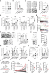 Figure 5. Tumor inflammation-elicited PIM2 expression displays an oncogenic function in hepatoma. A–D, Huh7 cells were incubated with T cell-CM, TAM-CM, or Co-CM for 24 hours. The proteins of survival-related genes (A) and apoptosis (B) in serum-starved tumor cells (n = 7), the migration of cells (C, n = 7), and the expression of EMT markers in cells (D, n = 4) were determined. Scale bar, 100 μm. E, GSEA of the metastasis and EMT-like signatures in PIM2high HCC samples versus PIM2low counterparts from the TCGA dataset. (F and G) Huh7 cells were pretreated with Co-CM for 12 hours, and then the effects of PIM2 inhibitor or knockdown of PIM2 expression with psi-LVRU6GP retroviral vector (shPIM2) on tumor cell migration (F, n = 6) and EMT marker expression (G, n = 4) were determined. Scale bar, 100 μm. H, Huh7 cells were left untreated or treated with a cocktail of cytokines, and the migration of cells was determined (n = 6). Scale bar, 100 μm. I, shNC and shPIM2 Huh7 cells were pretreated with or without Co-CM for 12 hours and then inoculated into dorsal tissues of NOD/SCID mice. Tumor sizes over the indicated time were analyzed (n = 7). (J and K) PIM2+ Huh7 cells were generated by incubating with Co-CM for 12 hours. Apoptosis of cells after exposure to activated T cells was determined at the indicated times (n = 4), and the effect of PIM2 inhibitor or knockdown of PIM2 expression with psi-LVRU6GP retroviral vector (shPIM2) on tumor cell apoptosis was analyzed at 24 hours (n = 7). L, Mice bearing Hepa1–6 hepatomas in the liver capsule for 8 days were treated with isotype control or αCSF1R Abs as described (Supplementary Fig. S5A). PIM2 expression in tumor tissues, tumor volume, and lung metastasis were analyzed (n = 5). Data represent mean ± SEM. *, P < 0.05; **, P < 0.01; ***, P < 0.001; and ****, P < 0.0001. One-way ANOVA with Bonferroni's correction (B–D, F, G, K), Student t test (H, L), or two-way ANOVA with Bonferroni's correction (I and J).