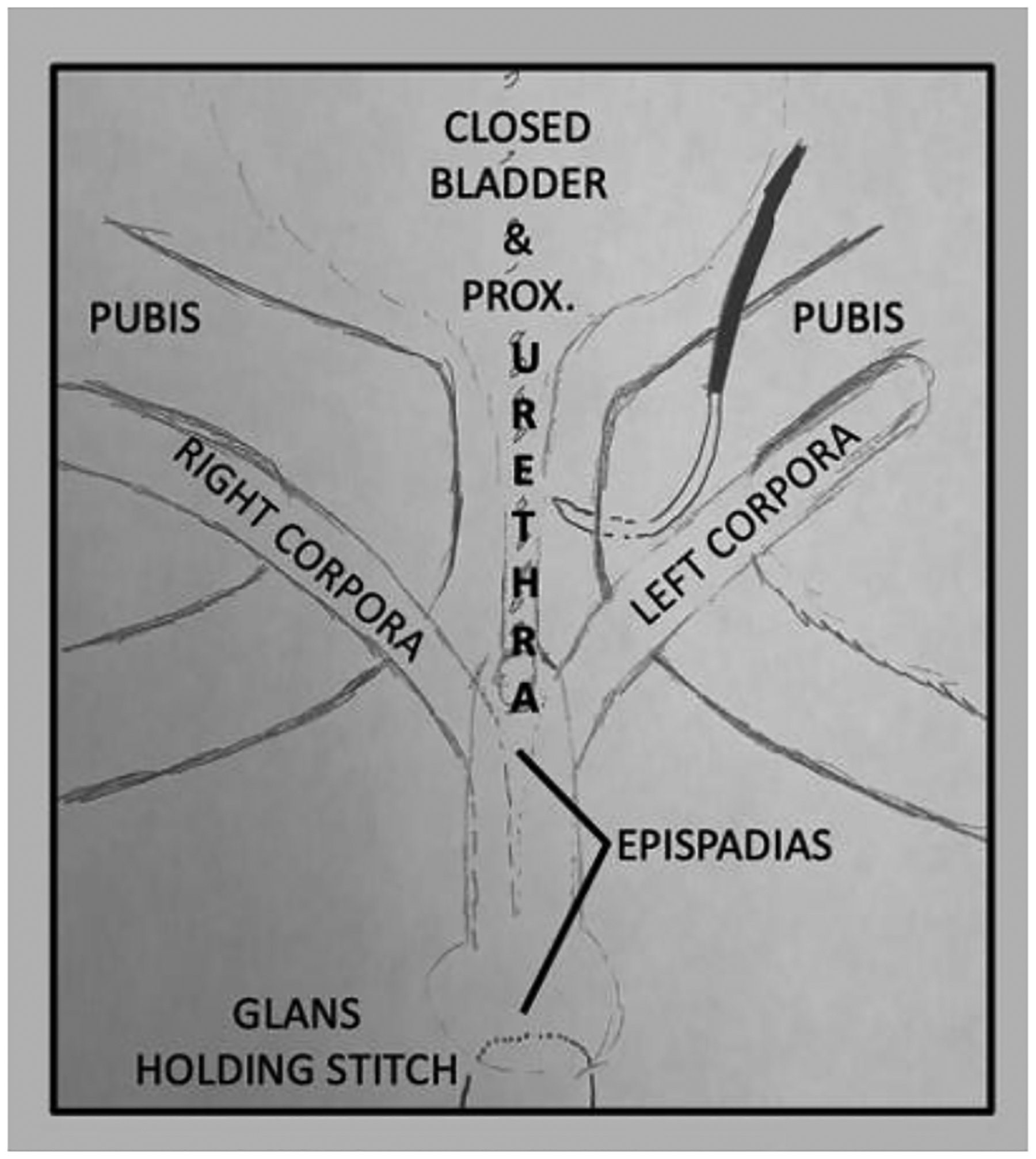 FIGURE 1a: