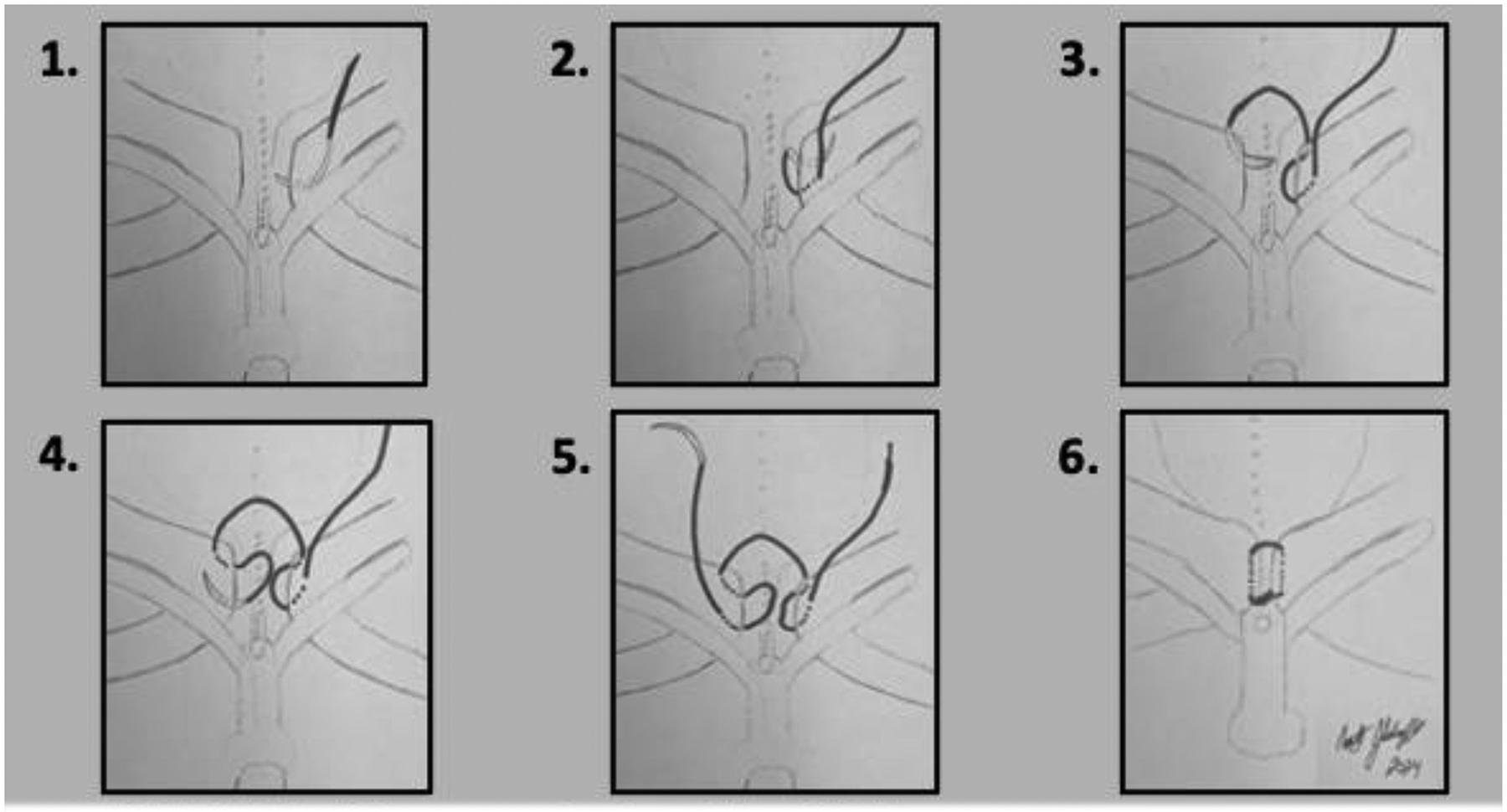 FIGURE 1b: