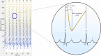 A Brain Tissue Velocimetry (Brain TV) recording displayed in MATLAB; a waterfall plot is produced where the signal from adjacent depths is offset by 20 µm