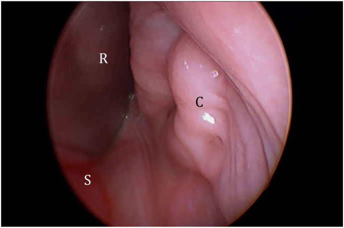 Fig. 3