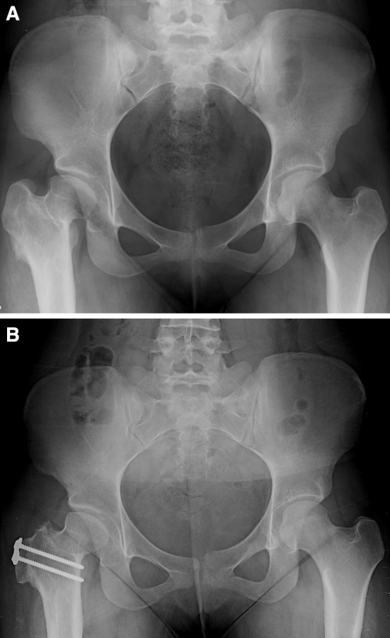 Fig. 1A–B