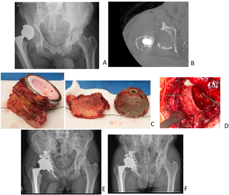 Fig. 3