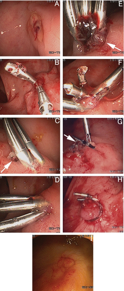 Figure 1)