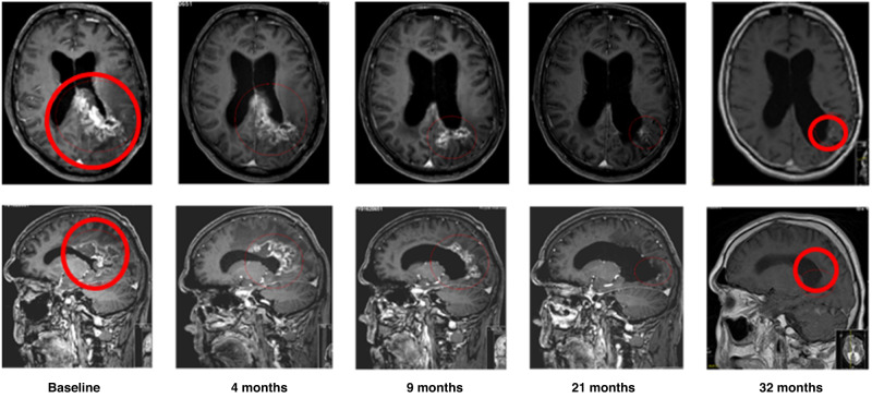 Fig. 4