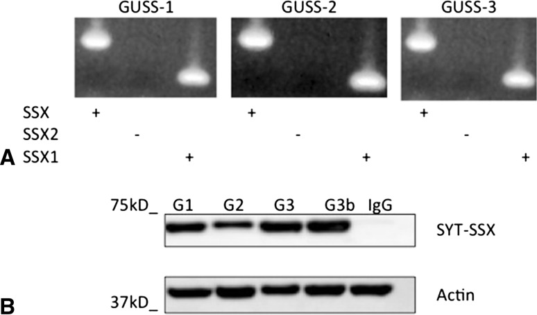 Fig. 2A–B