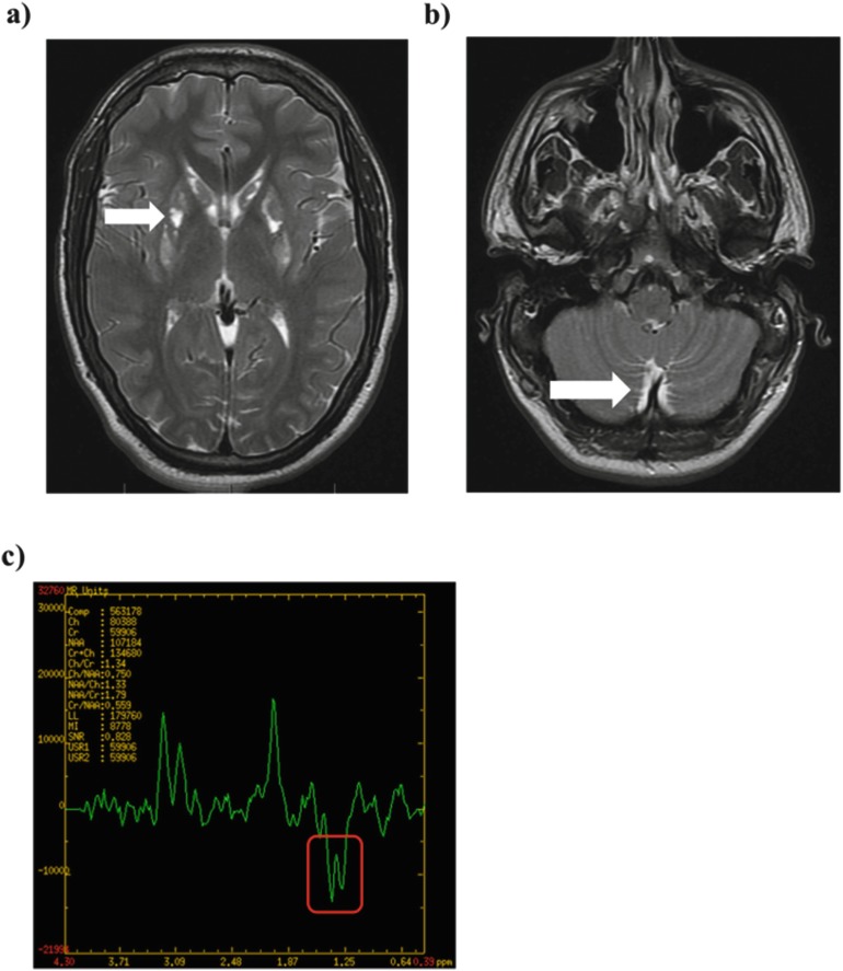 Fig. 2