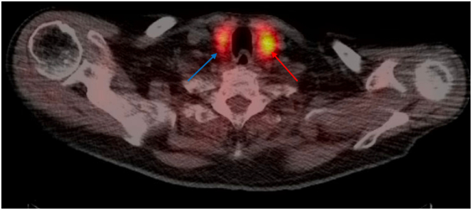 Fig. 2