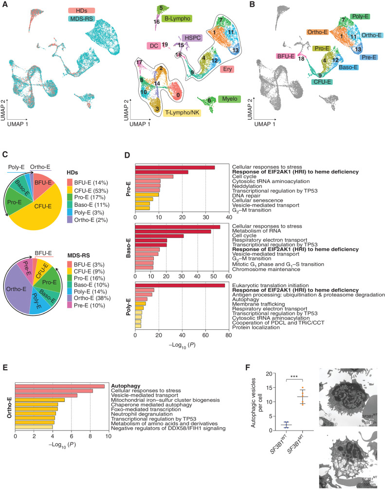 Figure 2. SF3B1MT arrest erythroid terminal differentiation and activate the EIF2AK1-induced response pathway to heme deficiency. A, UMAP plots of scRNA-seq data for pooled single MNCs isolated from two HD (n = 5,049) and five SF3B1-mutant MDS-RS (n = 16,212) samples. Each dot represents one cell. Different colors represent the sample origin (left) and cluster identity (right). B, UMAP plot of scRNA-seq data from A showing the 7 different stages of erythroid differentiation in the total erythroblast population. C, Distribution of the 7 stages of erythroid differentiation in the HD (top) and MDS-RS (bottom) erythroblast populations shown in A. Arrows indicate the terminal steps of erythroid differentiation. D, Pathway enrichment analyses of the genes that were significantly upregulated in Pro-E (top), Baso-E (middle), Poly-E (bottom) from MDS-RS samples as compared with those from HD samples (P ≤ 0.01) The top 10 Reactome gene sets are shown. E, Pathway enrichment analysis of the genes that were significantly upregulated in Ortho-E from MDS-RS samples as compared with those from HD samples (P ≤ 0.01) The top 10 Reactome gene sets are shown. F, Left, the number of autophagic vesicles per cell in SF3B1WT and SF3B1-mutant erythroblasts from one representative SF3B1WT and one SF3B1-mutant sample. Statistically significant differences were detected using a two-tailed Student t test. Right, representative transmission electron microscopy images of erythroblasts from the BM sections of one SF3B1WT and one SF3B1-mutant MDS sample. Scale bars, 500 nm. Baso-E, basophilic erythroblasts; BFU-E, burst-forming unit-erythroid cells; B-Lympho, B-lymphocytes; CFU-E, colony formation unit-erythroid cells; DC, dendritic cells; Ery, erythroblasts; HSPC, hematopoietic stem and progenitor cells; Myelo, myeloid cells; Ortho-E, orthochromatic erythroblasts; Poly-E, polychromatophilic erythroblasts; Pre-E, pre-erythrocytes; Pro-E, pro-erythroblasts; T-Lympho/NK, T-lymphocytes, and natural killer cells; UMAP, uniform manifold approximation and projection.