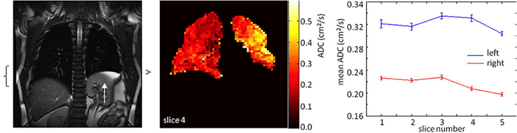 Fig. 11