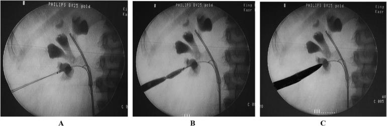 Fig. 4