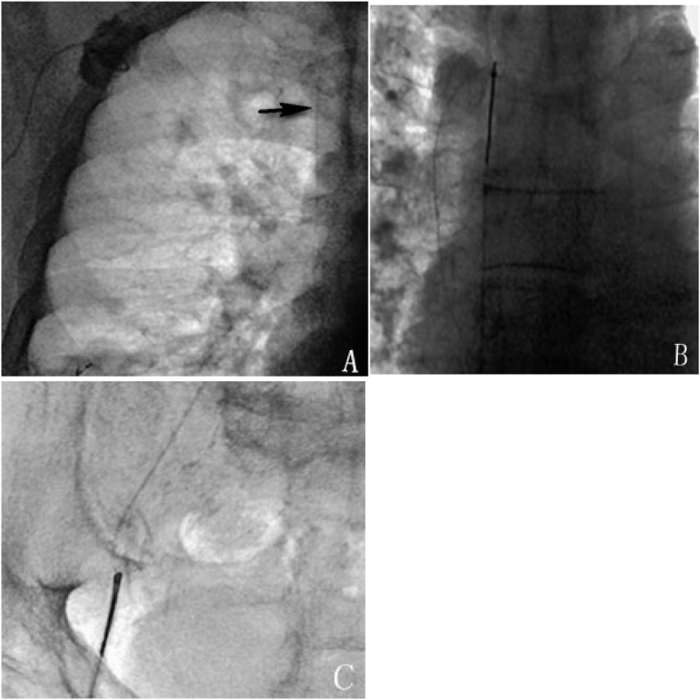 Fig. 3