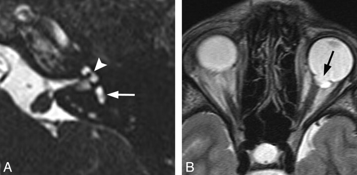 Fig 2.