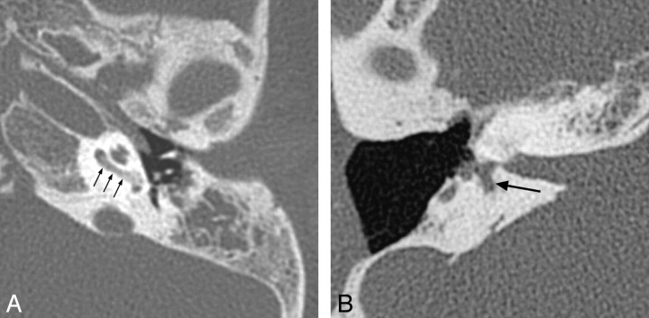 Fig 6.