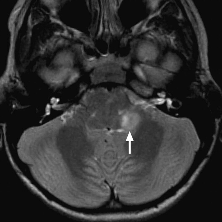 Fig 11.