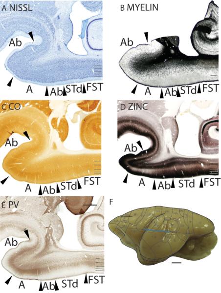 Figure 14