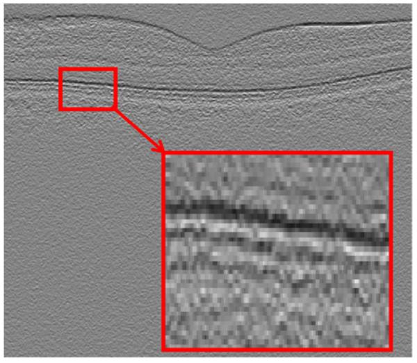 Fig. 11