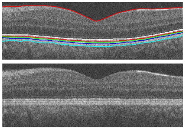 Fig. 12