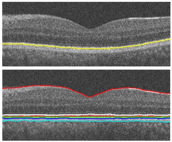 Fig. 18