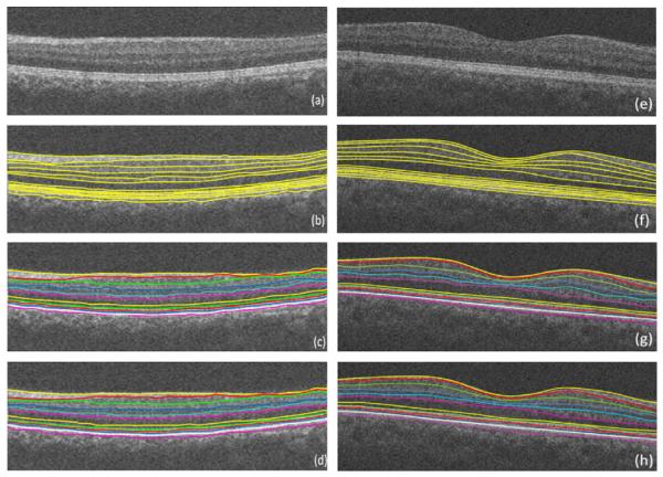 Fig. 31