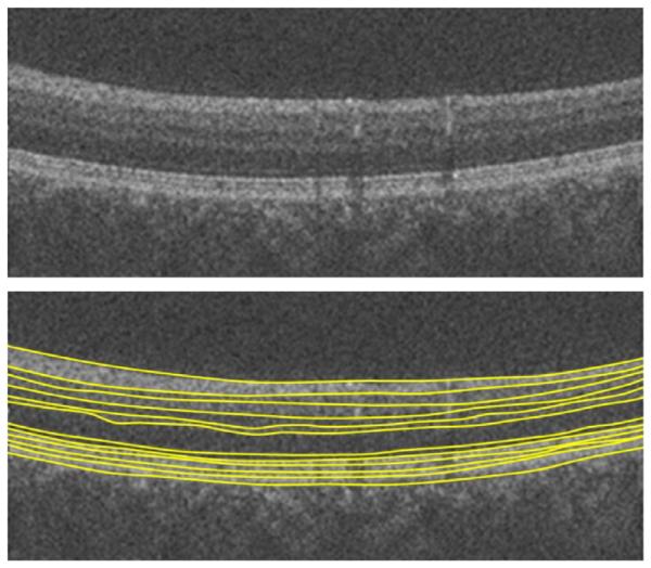 Fig. 32