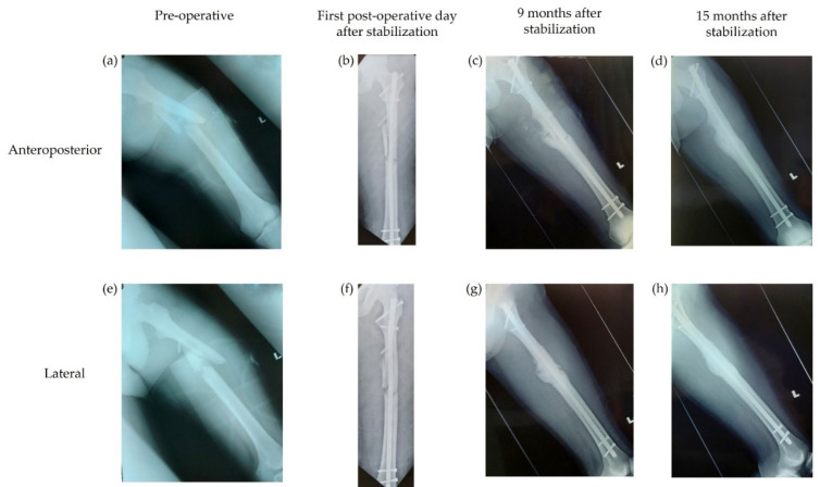 Figure 2