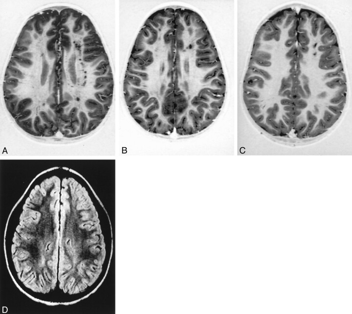 Fig 1.