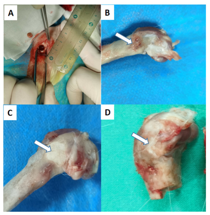 Figure 16