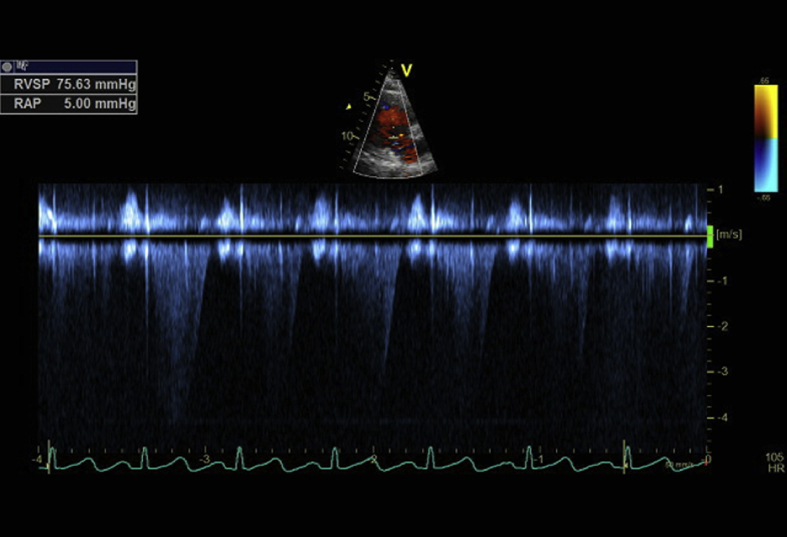 Fig. 2