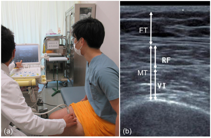 Fig. 1