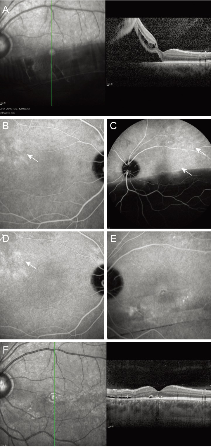 Fig. 2