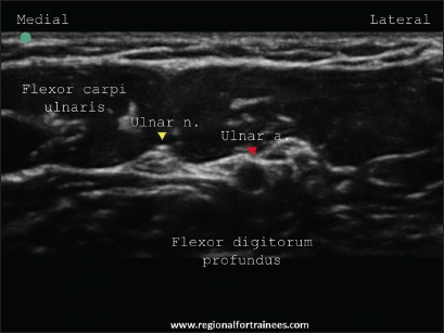 Figure 15b