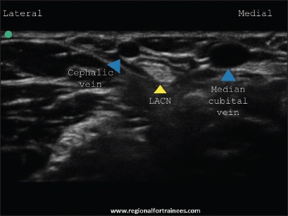 Figure 26b