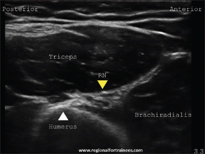 Figure 27a