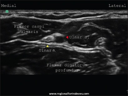 Figure 15a