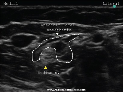 Figure 22b