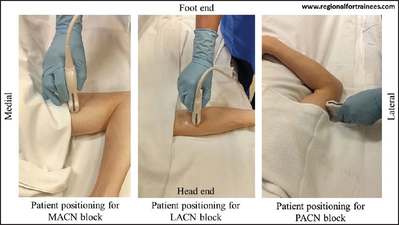 Figure 24