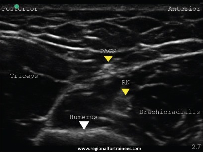 Figure 27b