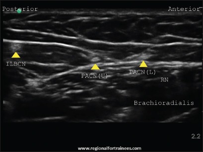 Figure 27c