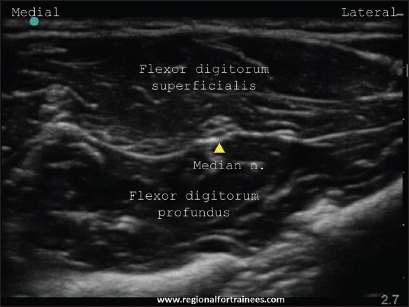 Figure 21b