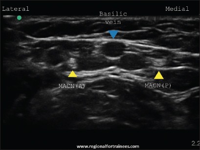 Figure 25b